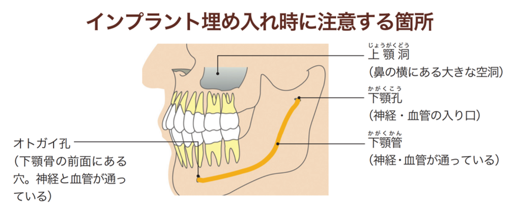 より安全なインプラント治療のために、術前検査はお口の中から全身まで。
