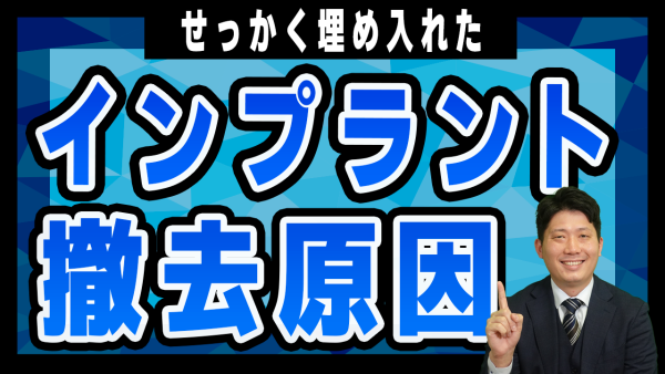 インプラントを外さなければならなくなる原因を4つ紹介します