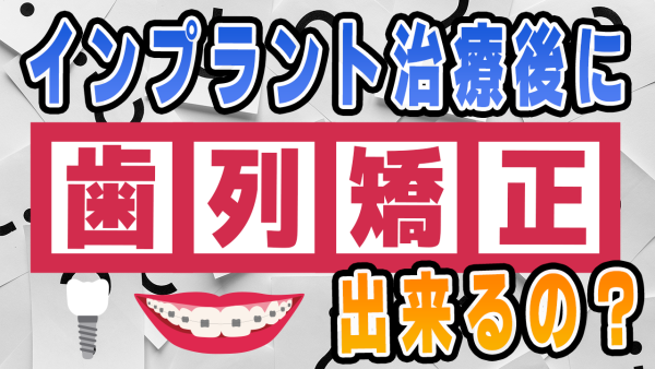 インプラント治療後に歯列矯正はできる？