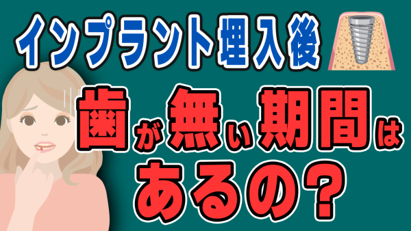 インプラント治療で歯がない期間はどのくらいある？【仮歯】